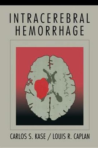 Cover of Intracerebral Hemorrhage