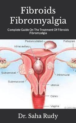 Book cover for Fibroids Fibromyalgia