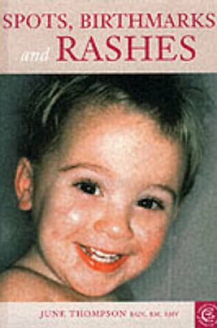 Cover of Spots, Birthmarks and Rashes