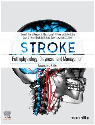 Cover of Stroke E-Book