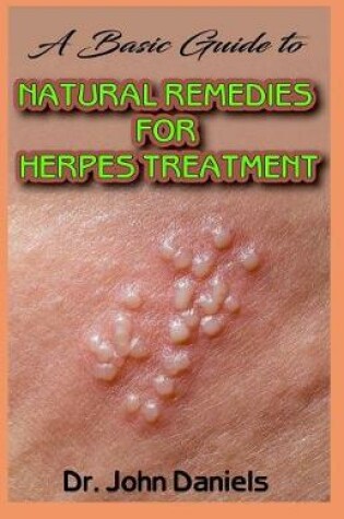 Cover of A Basic Guide To Natural Remedies for Herpes Treatment