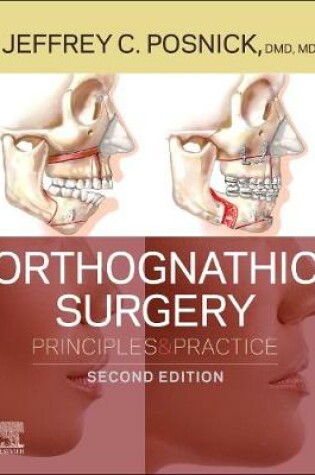 Cover of Orthognathic Surgery E-Book