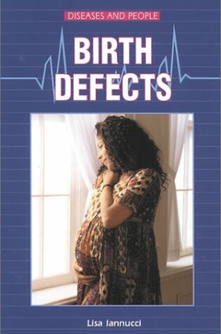 Cover of Birth Defects