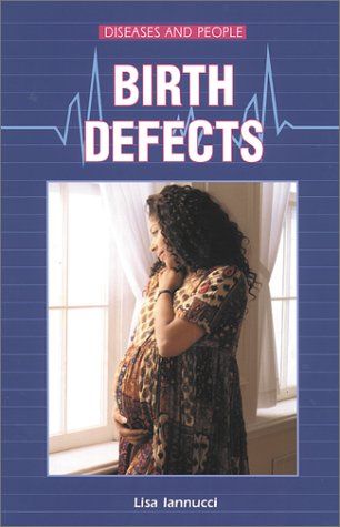 Book cover for Birth Defects