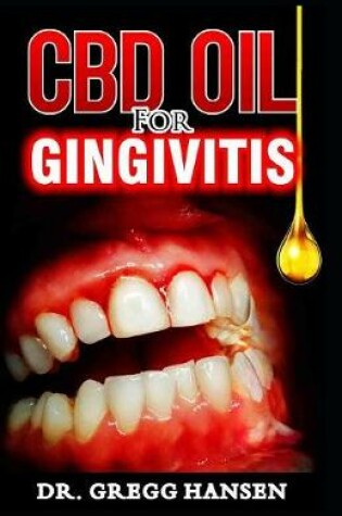 Cover of CBD Oil for Gingivitis