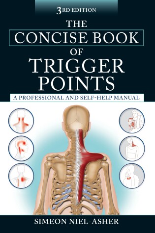 Cover of The Concise Book of Trigger Points, Third Edition