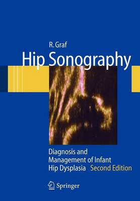 Book cover for Hip Sonography