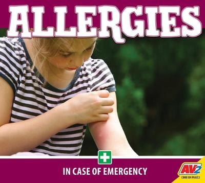 Cover of Allergies