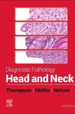 Cover of Head and Neck, E-Book