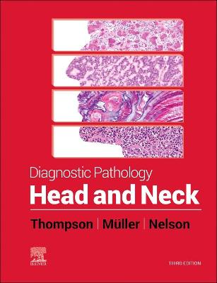 Cover of Head and Neck, E-Book