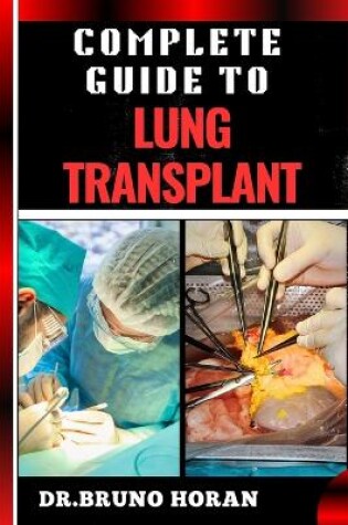 Cover of Complete Guide to Lung Transplant