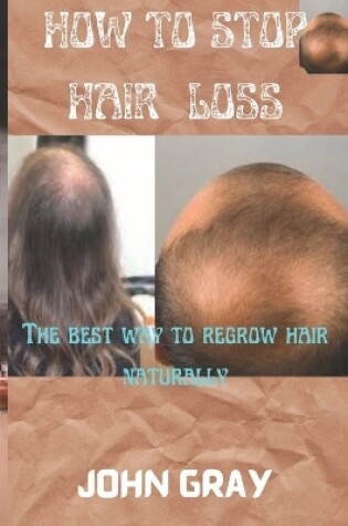 Cover of How to stop hair loss