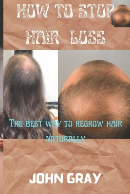 Book cover for How to stop hair loss