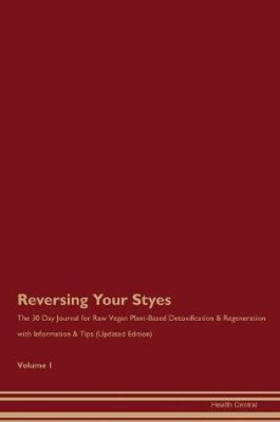 Cover of Reversing Your Styes