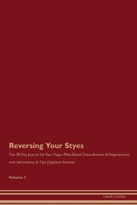 Book cover for Reversing Your Styes