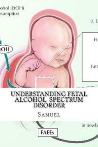 Cover of Understanding Fetal Alcohol Spectrum Disorder