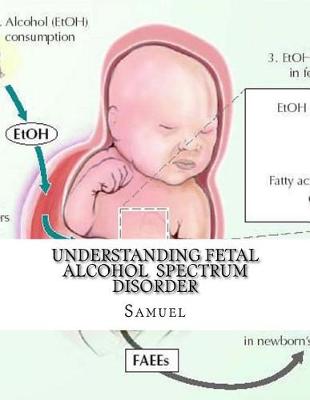 Book cover for Understanding Fetal Alcohol Spectrum Disorder