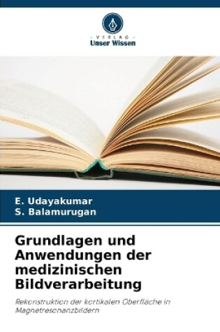 Cover of Grundlagen und Anwendungen der medizinischen Bildverarbeitung