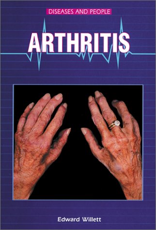 Book cover for Arthritis