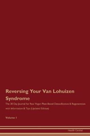 Cover of Reversing Your Van Lohuizen Syndrome