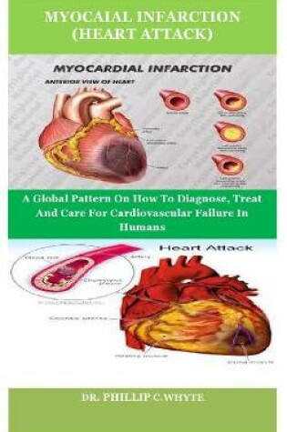 Cover of Myocaial Infarction (Heart Attack)