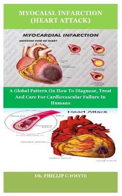 Book cover for Myocaial Infarction (Heart Attack)