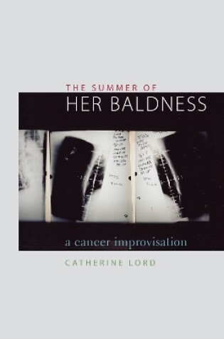 Cover of The Summer of Her Baldness