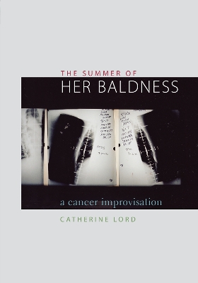 Book cover for The Summer of Her Baldness