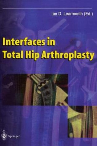 Cover of Interfaces in Total Hip Arthroplasty