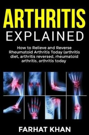 Cover of Arthritis Explained