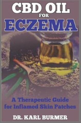 Cover of CBD Oil for Eczema