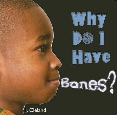 Cover of Why Do I Have Bones?