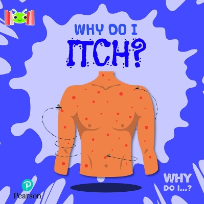 Cover of Bug Club Reading Corner: Age 5-7: Why Do I Itch?