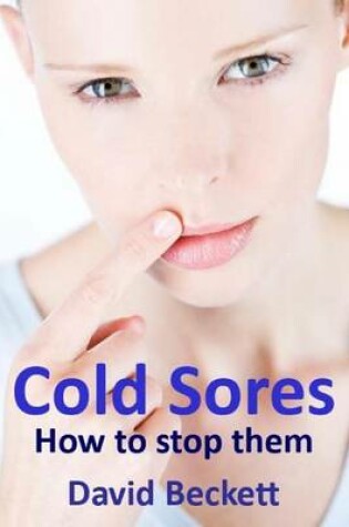 Cover of Cold Sores