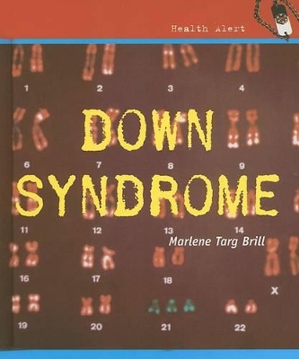 Book cover for Down Syndrome