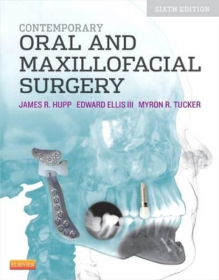 Book cover for Contemporary Oral and Maxillofacial Surgery