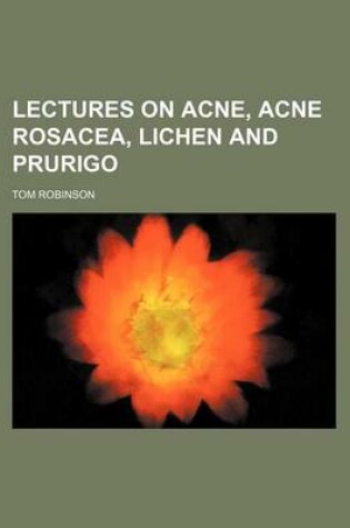 Cover of Lectures on Acne, Acne Rosacea, Lichen and Prurigo