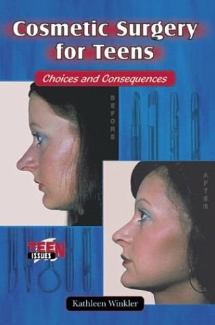 Cover of Cosmetic Surgery for Teens