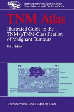 Cover of Tnm Atlas