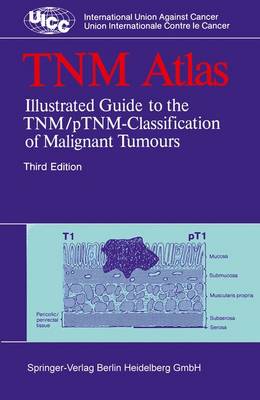 Book cover for Tnm Atlas