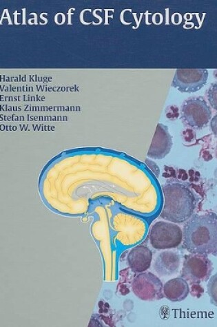 Cover of Atlas of CSF Cytology