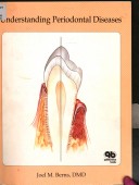 Book cover for Understanding Periodontal Diseases