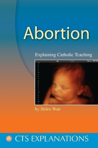 Cover of Abortion