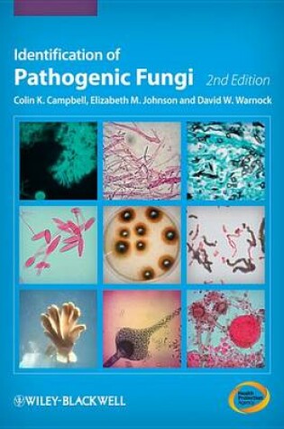 Cover of Identification of Pathogenic Fungi