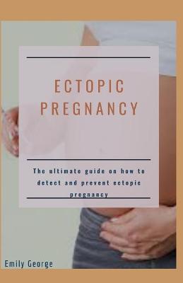 Book cover for Ectopic Pregnancy