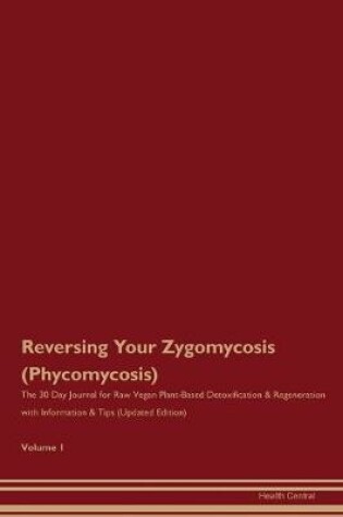 Cover of Reversing Your Zygomycosis (Phycomycosis)