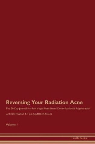 Cover of Reversing Your Radiation Acne