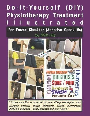 Book cover for Physiotherapy Treatment Illustrated for Frozen Shoulder (Adhesive Capsulitis)