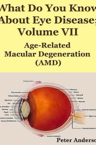 Cover of What Do You Know About Eye Disease; Volume VII: Age-Related Macular Degeneration (AMD)