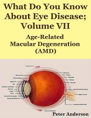 Book cover for What Do You Know About Eye Disease; Volume VII: Age-Related Macular Degeneration (AMD)